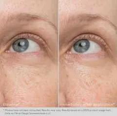 Gel crema de rejuvenare pentru zona ochilor Obagi Daily Hydro-Drops® Rejuvenating Eye Gel Cream, 15 gr