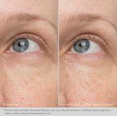 Gel crema de rejuvenare pentru zona ochilor Obagi Daily Hydro-Drops® Rejuvenating Eye Gel Cream, 15 gr